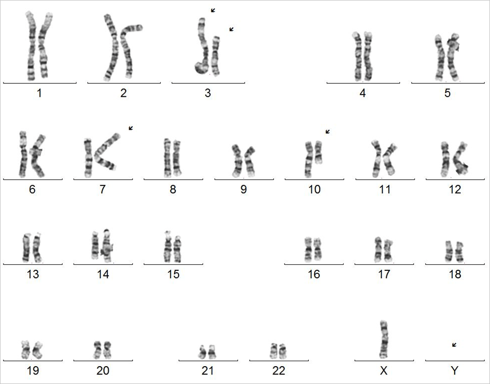 Sitogenetik detail 1